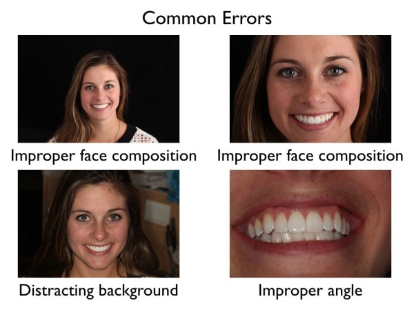 Common Dental Photography Errors
