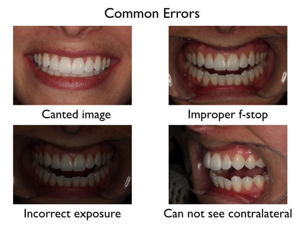Common Dental Photography Errors