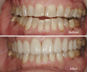 4 Successful Dental Cases to Inspire You This Week