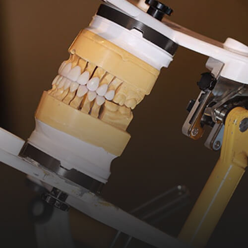 3D model of teeth being hold by a machine